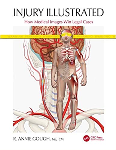 Book cover of Injury Illustrated